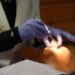 Ekstrakcja ósemki wskazania według stomatologa